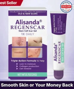 Alisanda® ReGenScar Kabakaba ƒe Abi ƒe Gel