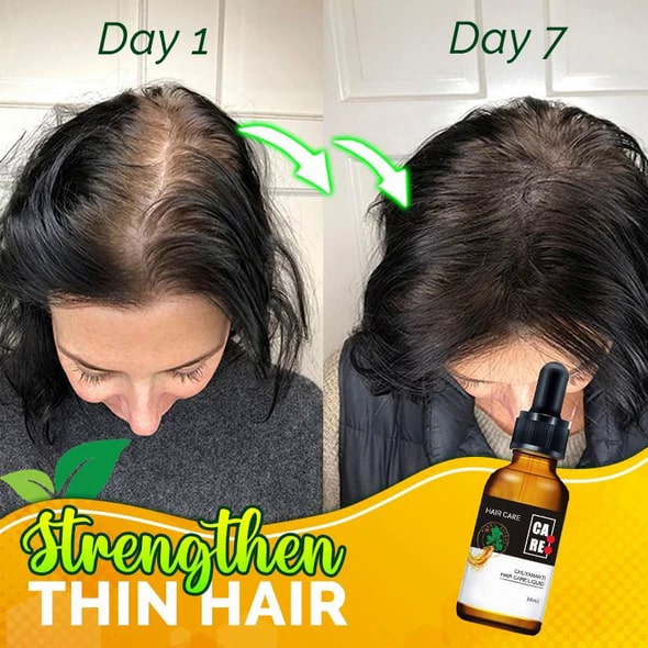 10X-Regro tugevate juuste seerum