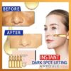Instant Dark Spot Lifting Ampull