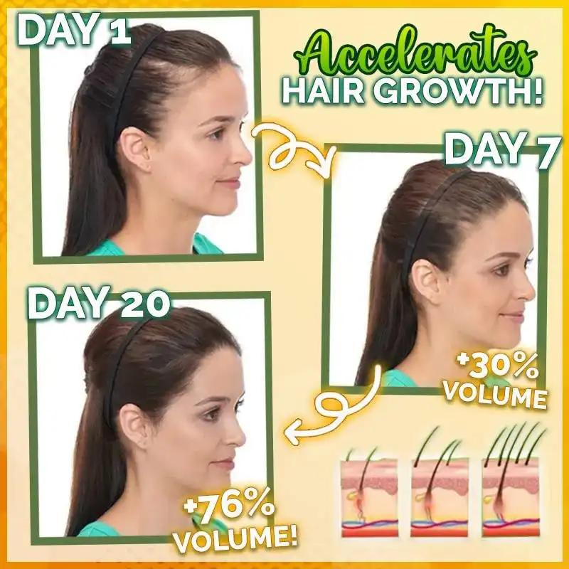 10X-Regro tugevate juuste seerum - Image 2