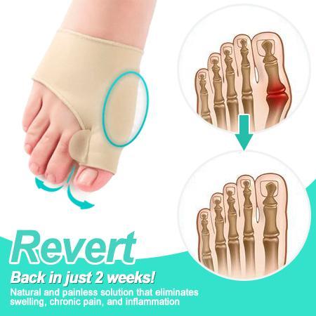 LOODUSLIKUD JALAD Bunion Corrector - Image 2