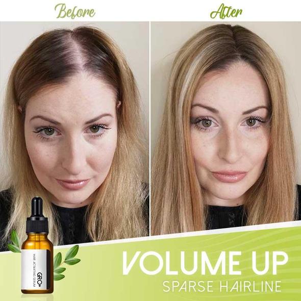 Gro+ juukseid aktiveeriv seerum - Image 4