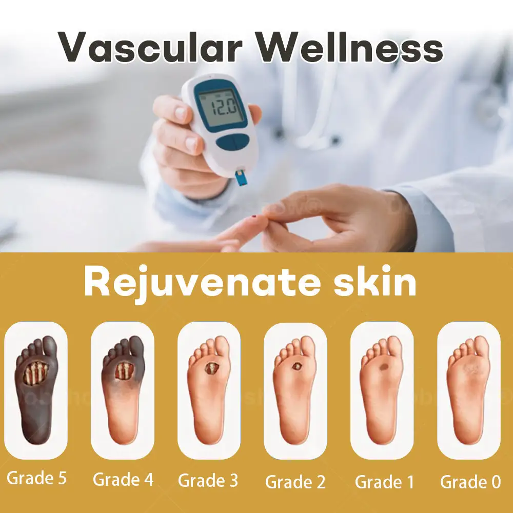 GlucoShield mesilasmürgi haavasprei - Image 2