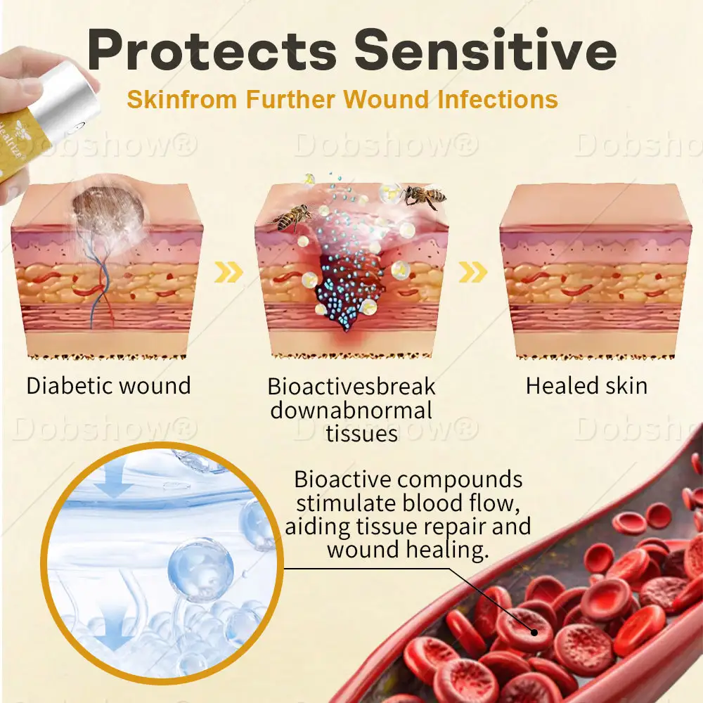 GlucoShield mesilasmürgi haavasprei - Image 3