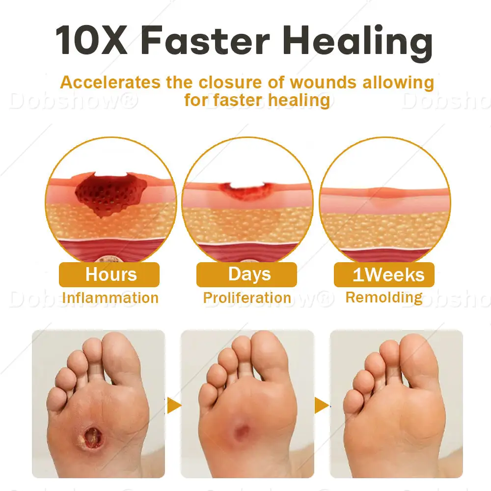 GlucoShield mesilasmürgi haavasprei - Image 4