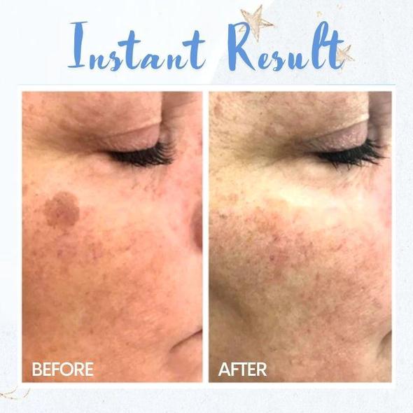 Pliiats täppide eemaldamiseks - Image 3