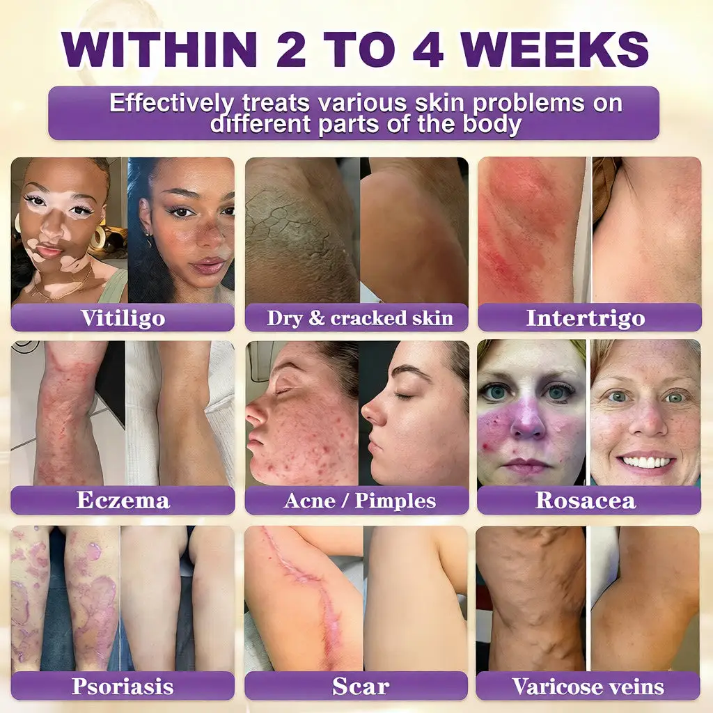 Biotiin 10-ühes nahka taastav kreem - Image 2