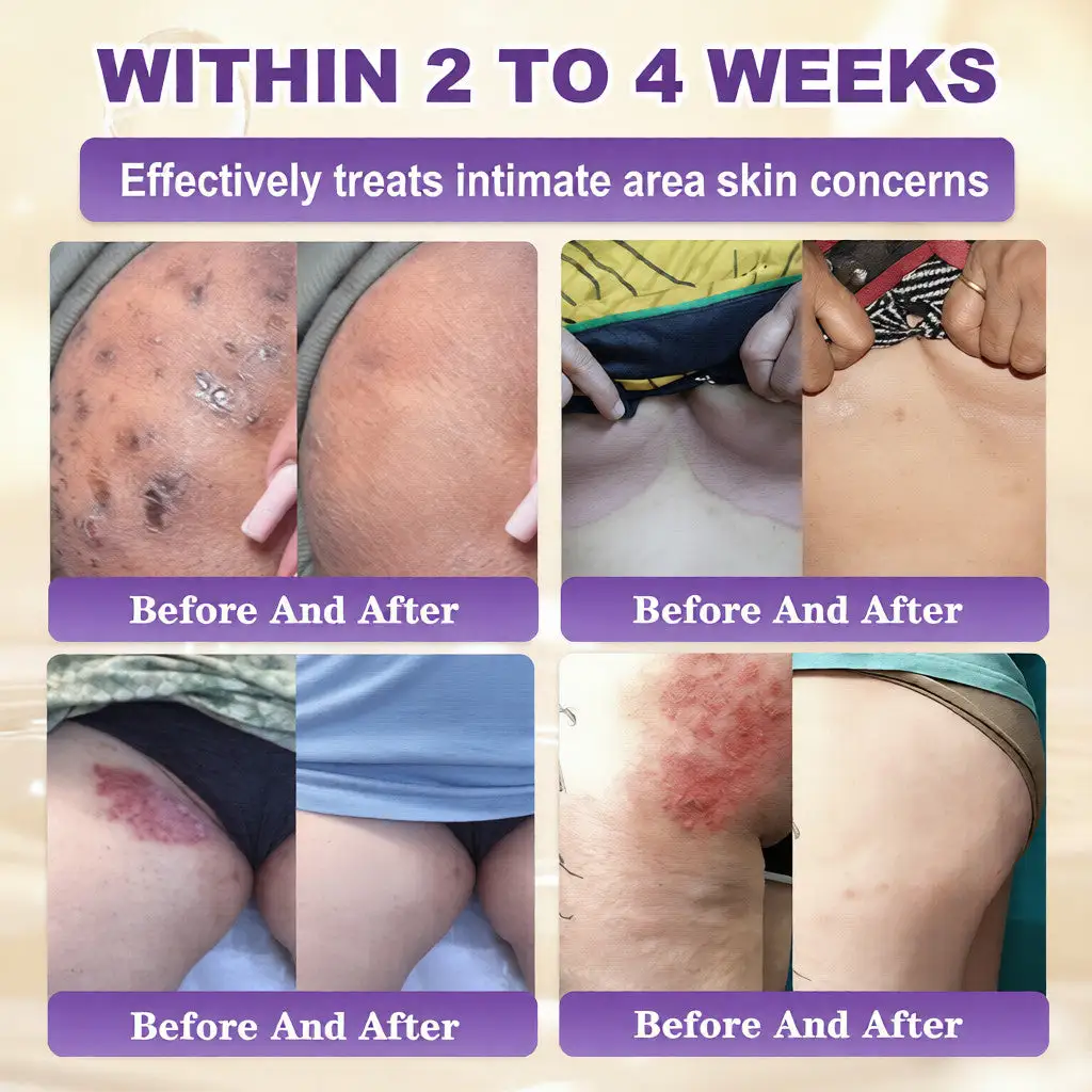 Biotiin 10-ühes nahka taastav kreem - Image 4