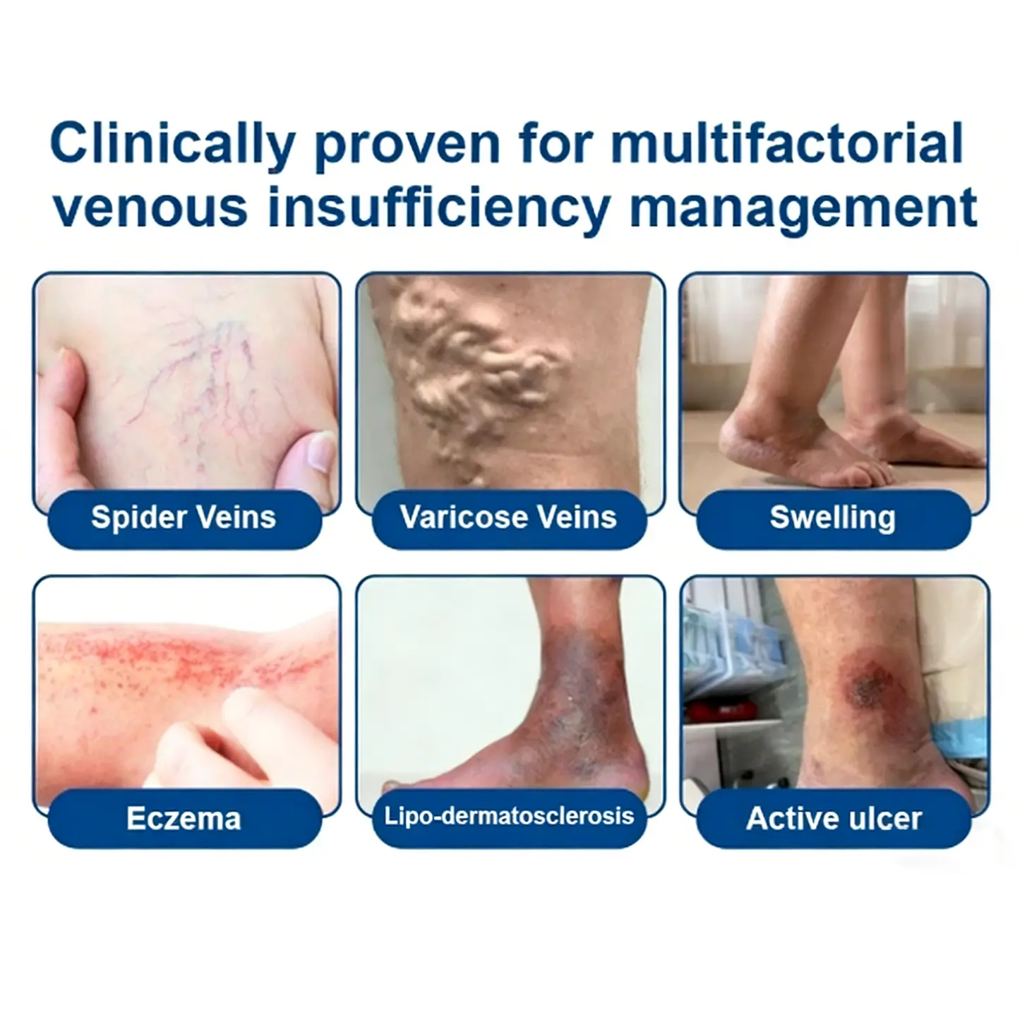 ๐ฝ๐ฒ๐ถ๐ฃ ๐พ๐จ๐ง๐๐ผ๐ช๐ง ๐๐๐๐ซ๐๐๐๐ฒ๐ฑ๐น๐ - Image 3