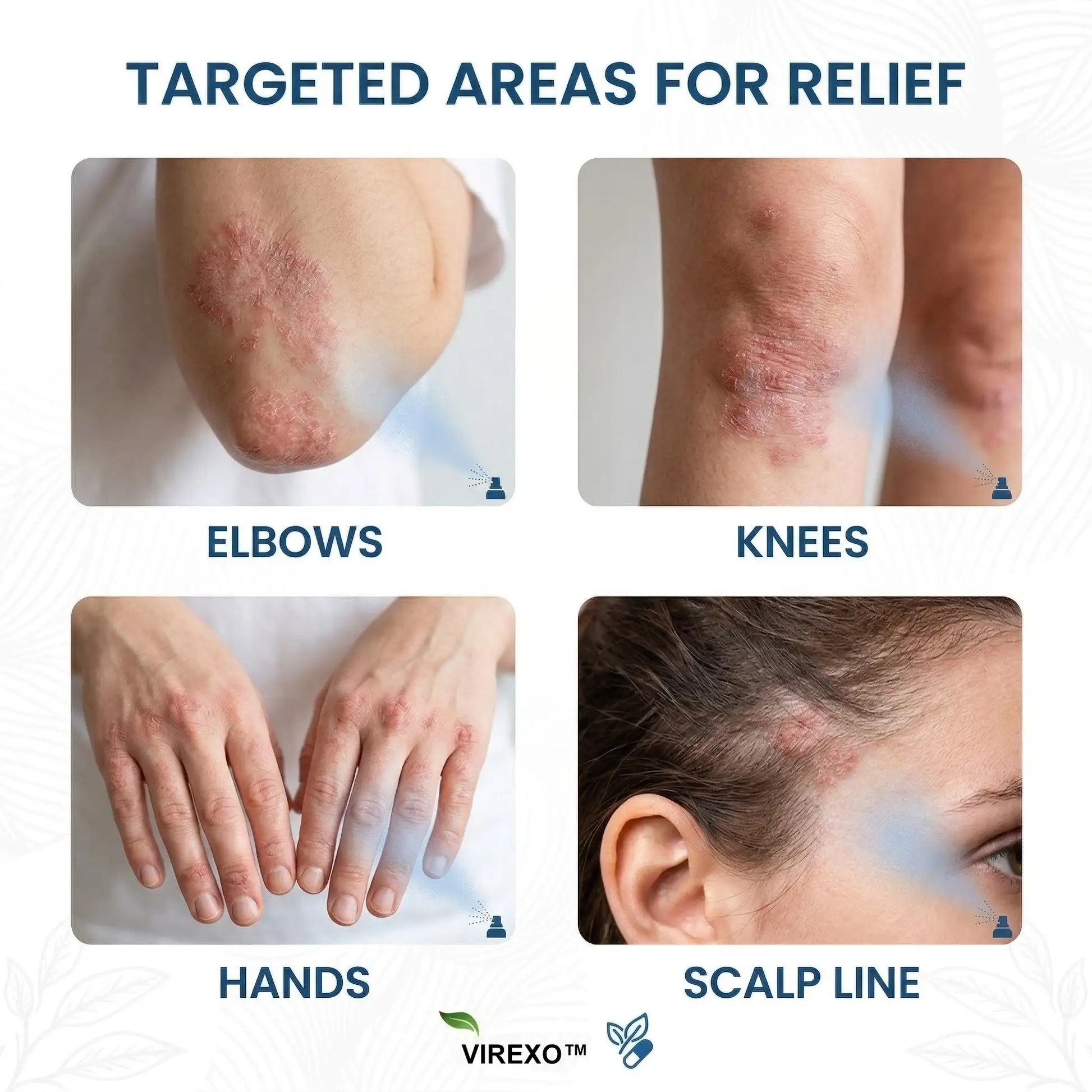 Magneesiumi botaaniline pihusti - Image 2