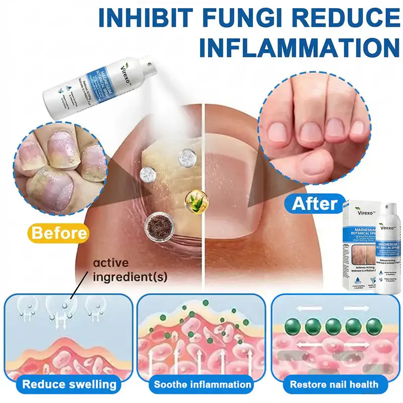 Magneesiumi botaaniline pihusti - Image 4